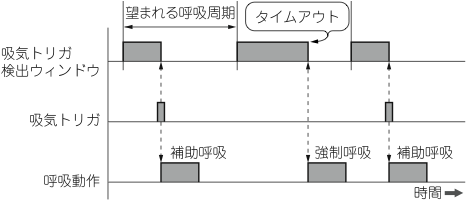 人工呼吸器に見るセーフティ クリティカル システム設計 2重3重のバックアップで生命を守る Tech Village テックビレッジ Cq出版株式会社